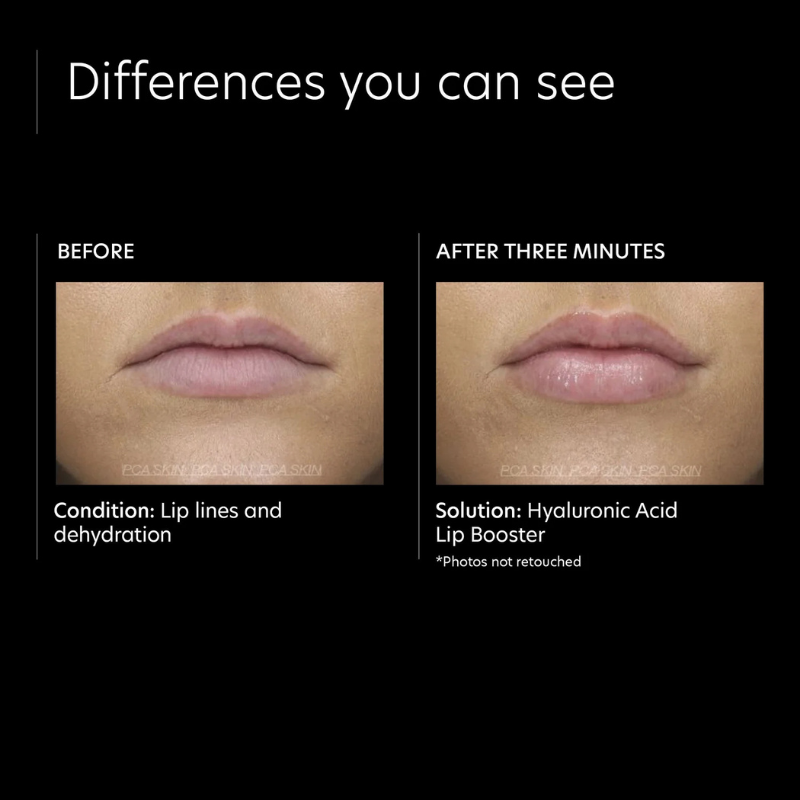 PCA Skin HA Lip Boosting Serum – Hydrating, Plumping & Softening Treatment