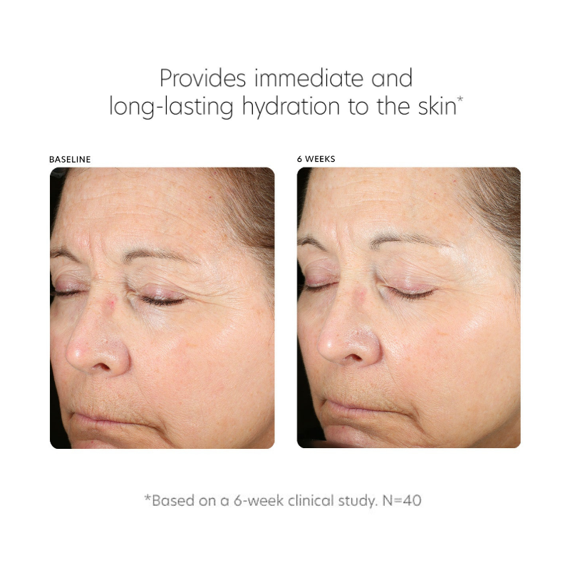 PCA SKIN Hyaluronic Acid Boosting Serum (1 fl oz)